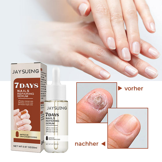 7 Tage Nagelwachstums- und Stärkungsserum