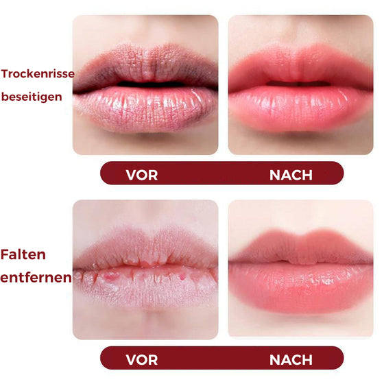 Blasenlippenmaske