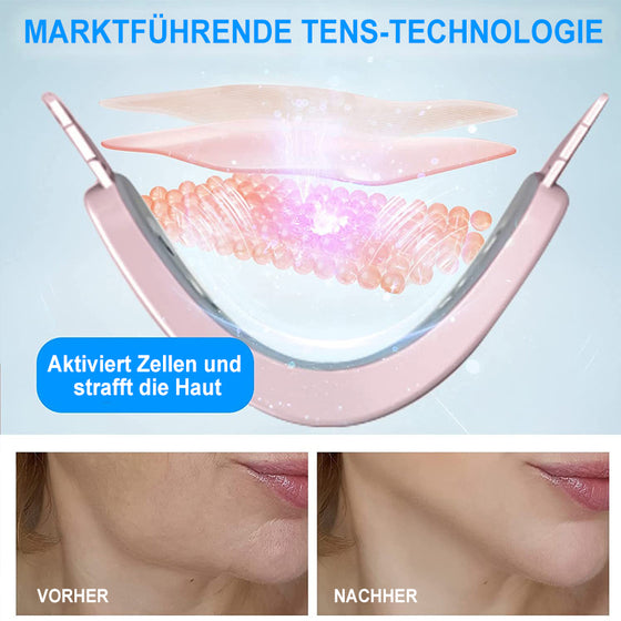 V-förmiges Facelifting-Instrument